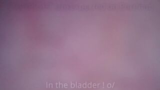 Urethra bladder insertion with diy endoscope - amateur