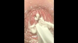 Big anal dildo ride by hot boy whit milk anal prolapse.