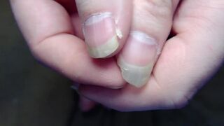 Messing with my camera by showing off my hands and feet