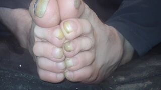Toenails have gotten long and ugly