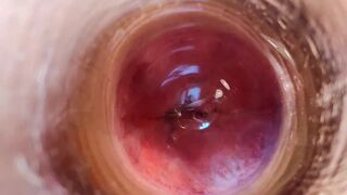 Fucking ass 19. Peniscope