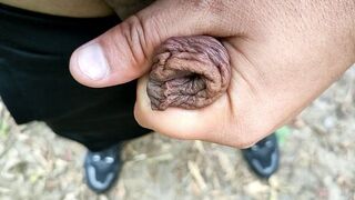 Outdoor slowmotion foreskin filling with piss - filled foreskin like balloon with pee