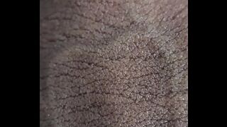 WHAT ARE THESE SPOTS ON MY PENIS? A VERY CLOSE UP