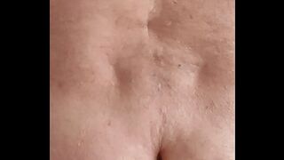 Kalle with 2 thick lumps that have a diameter of 10cm
