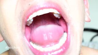 Uvula fetish