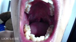 Opening the mouth very wide until the uvula