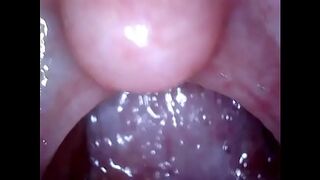 Endoscope on male body